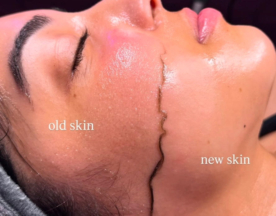Hair Removal Sugaring Services (1)